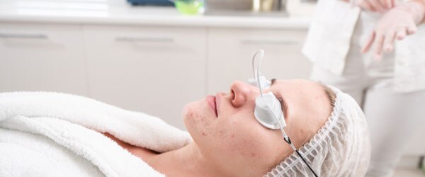 Acne-laser-treatment
