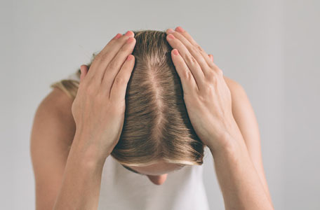 L1 : Hair loss or alopecia: causes and treatments | Ducray