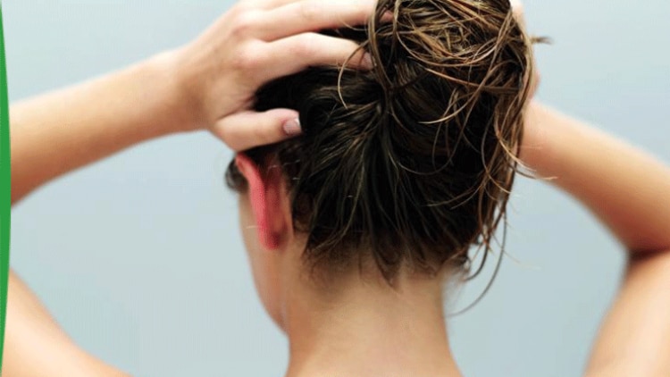 photo-itching-of-the-scalp-sensinol