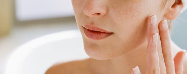 Adult acne can be treated as well as adolescent acne