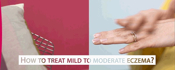 Episode 2 : How to treat mild to moderate eczema 